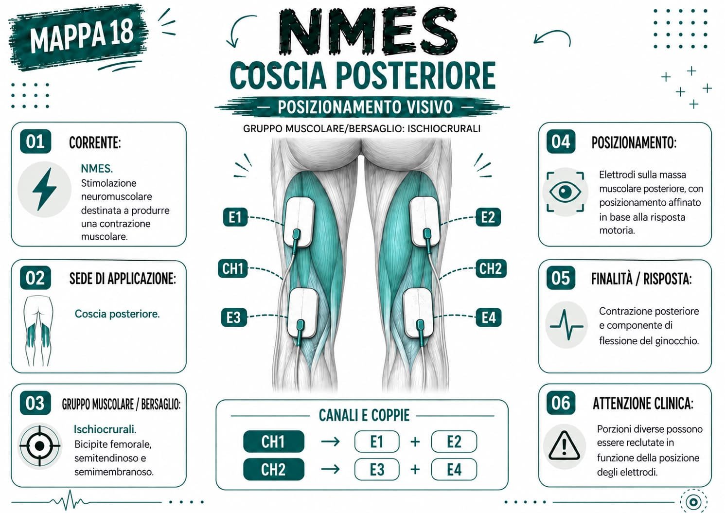 NMES muscoli ischiocrurali